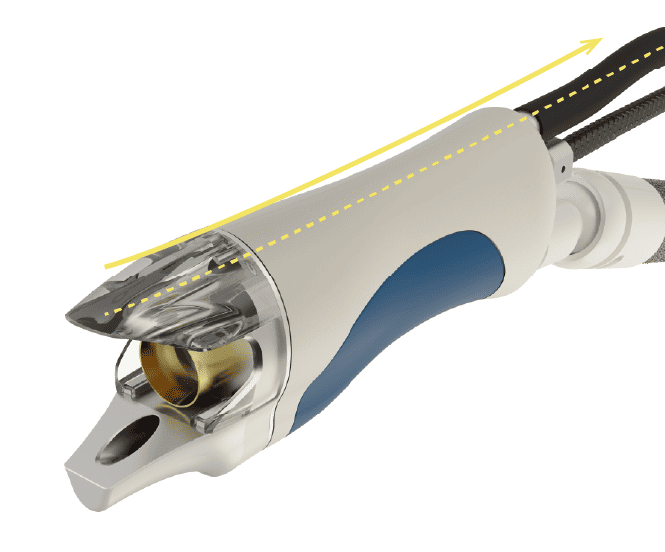 医療脱毛（スプレンダーX） | 徳島の美容整形ならしらさぎ形成クリニック